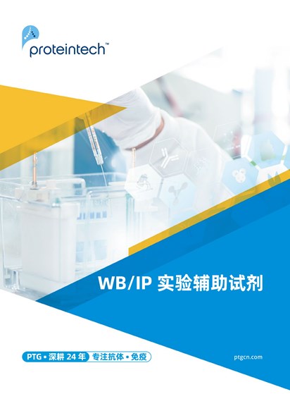 WB/IP 实验辅助试剂
