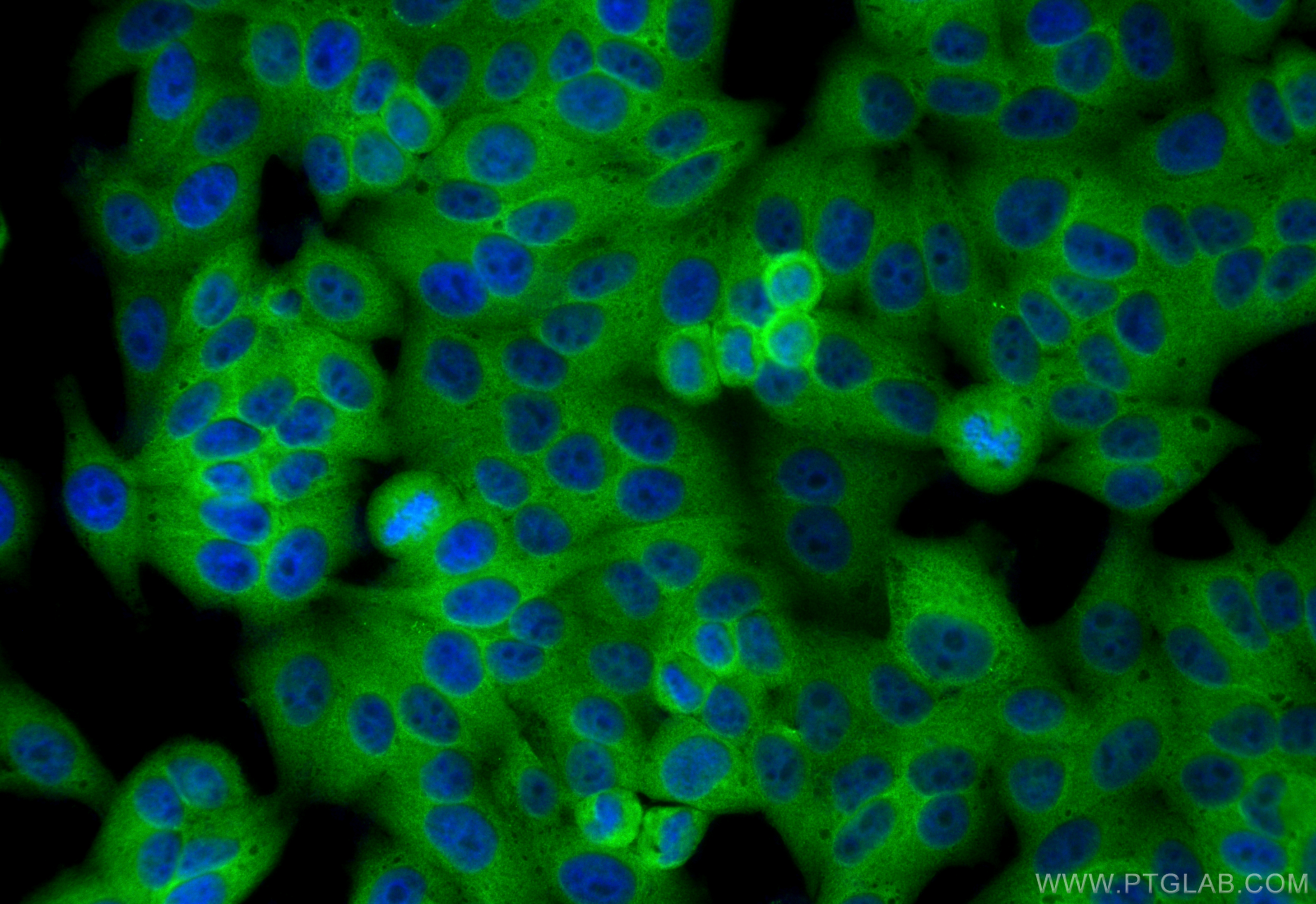IF Staining of HepG2 using 14503-1-AP