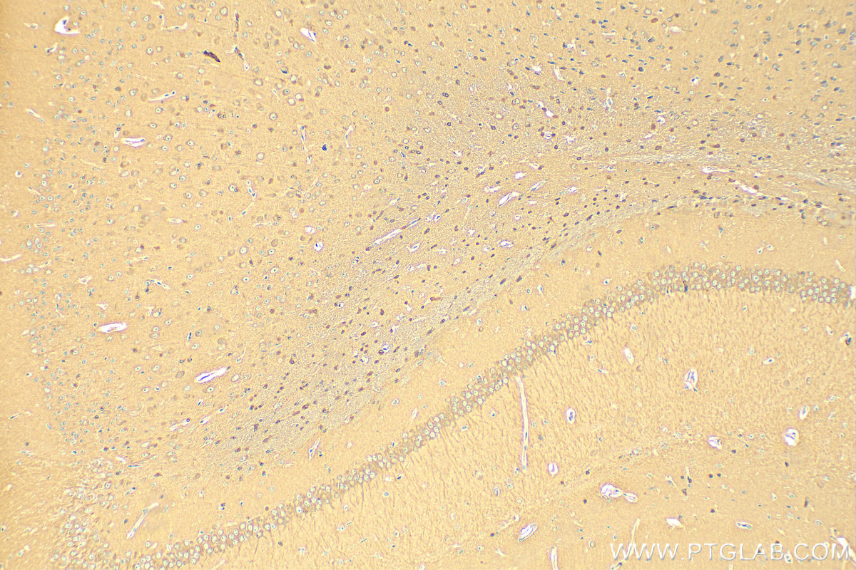 IHC staining of mouse brain using 14503-1-AP