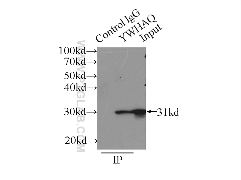 IP experiment of mouse lung using 14503-1-AP