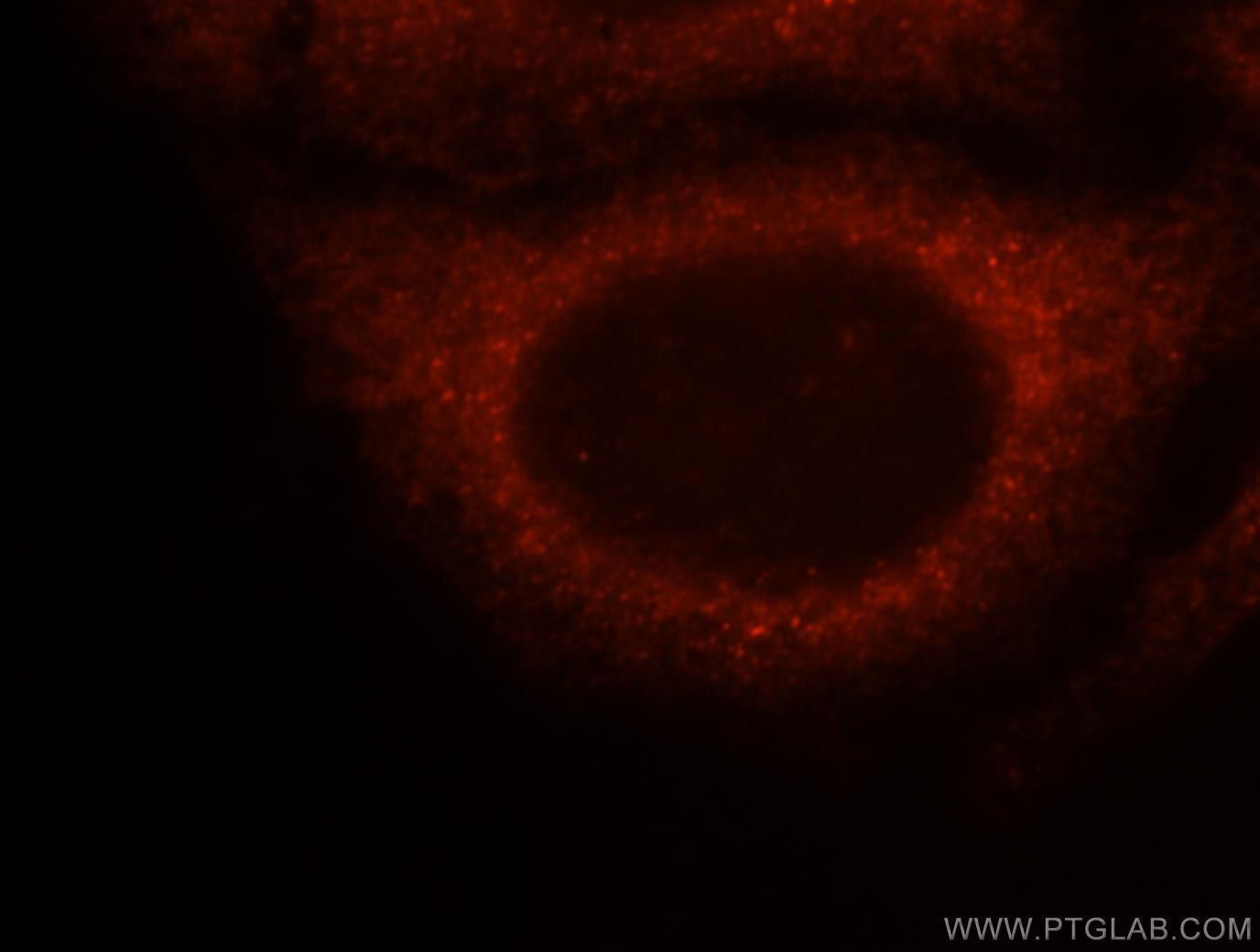 IF Staining of HepG2 using 11648-2-AP