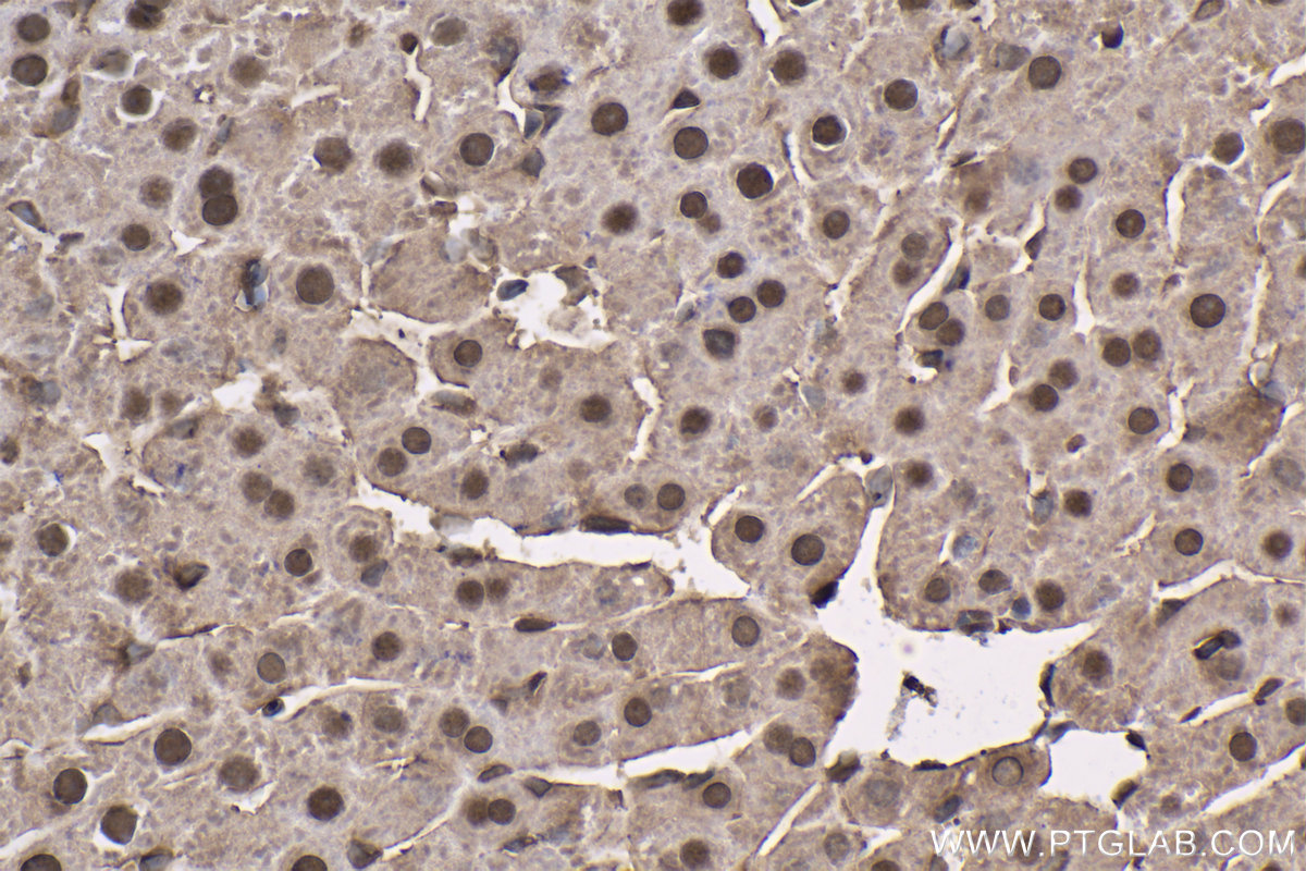 IHC staining of rat liver using 66946-1-Ig (same clone as 66946-1-PBS)