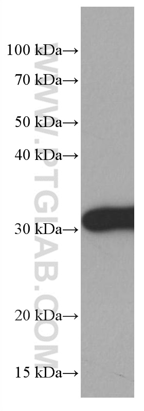 WB analysis of HeLa using 66946-1-Ig (same clone as 66946-1-PBS)
