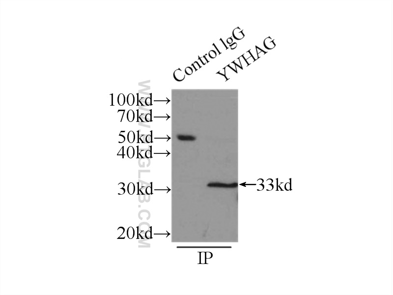 IP experiment of mouse brain using 12381-1-AP