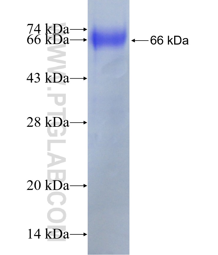 2019-nCOV nucleocapsid phosphoprotein fusion protein Ag31125 SDS-PAGE