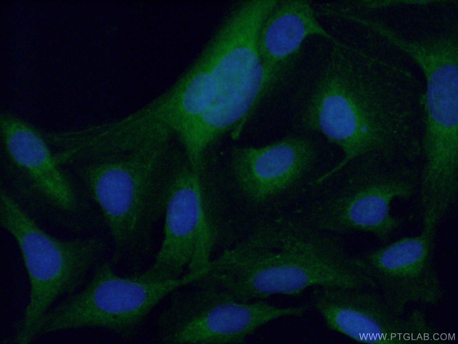 IF Staining of U2OS using 55163-1-AP