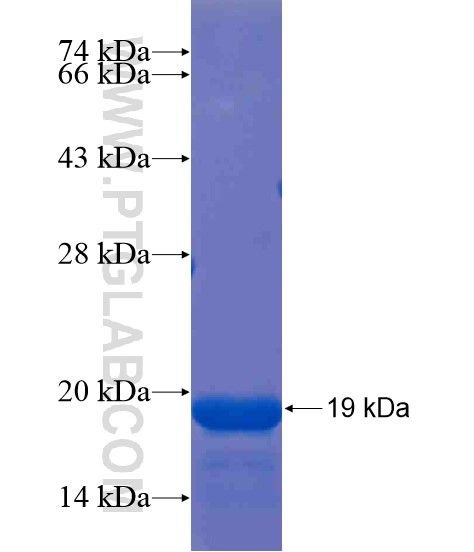 364CN fusion protein Ag21492 SDS-PAGE