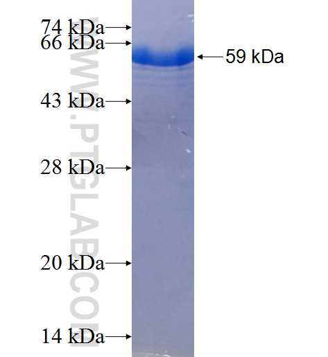 477cn fusion protein Ag25540 SDS-PAGE