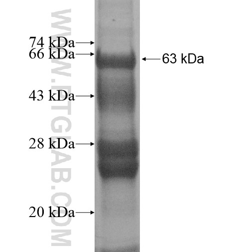4921513D23Rik fusion protein Ag13543 SDS-PAGE 4921513D23Rik fusion protein Ag13543 SDS-PAGE