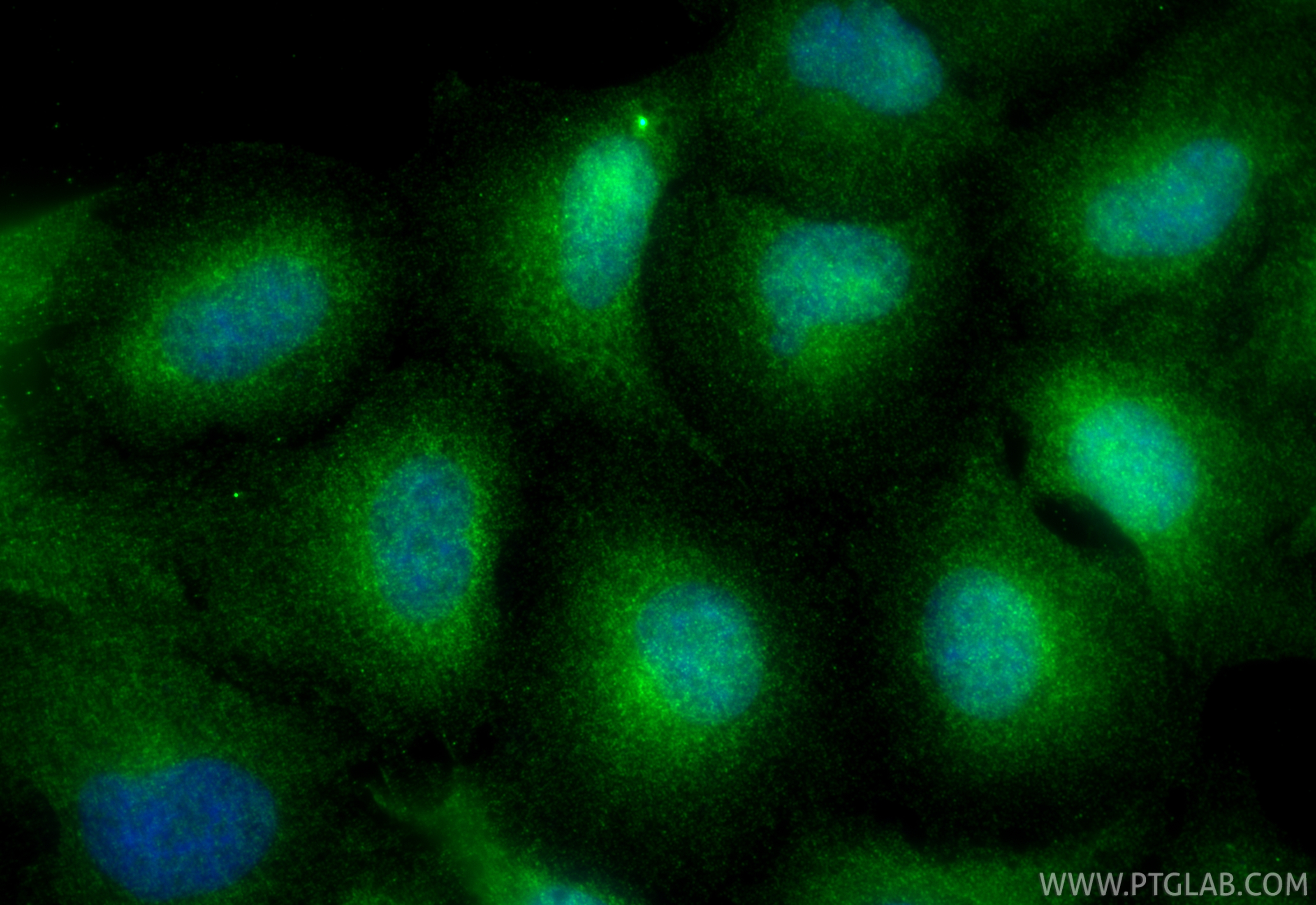 IF Staining of A549 using 13988-1-AP