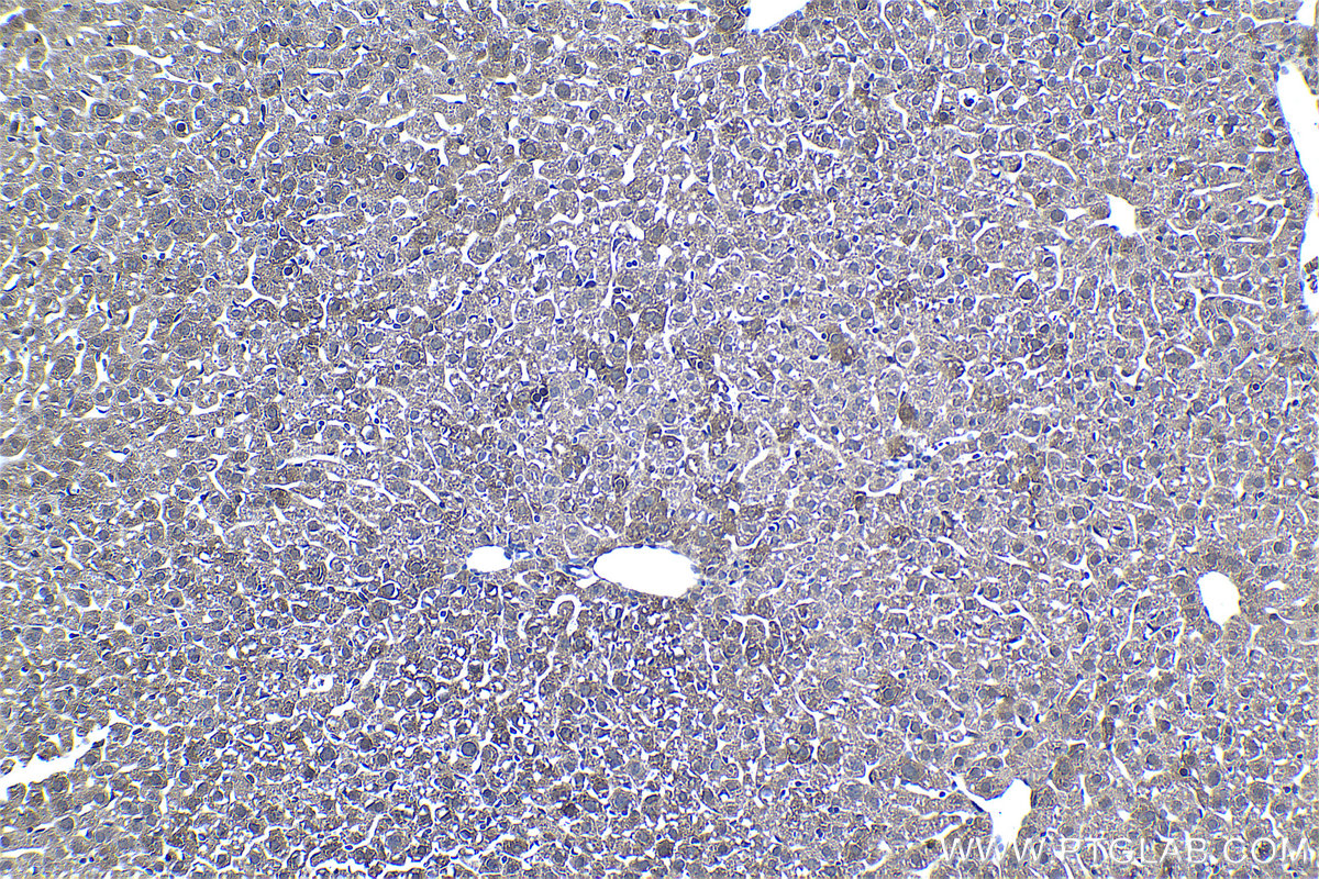 IHC staining of mouse liver using 60246-1-Ig