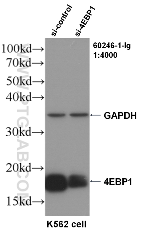 WB analysis of K562 using 60246-1-Ig