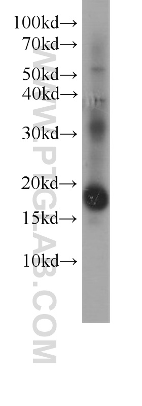 4EBP1 Monoclonal antibody