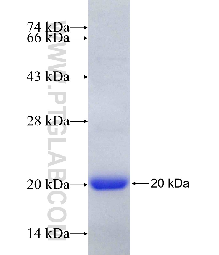 4EBP1 fusion protein Ag18985 SDS-PAGE