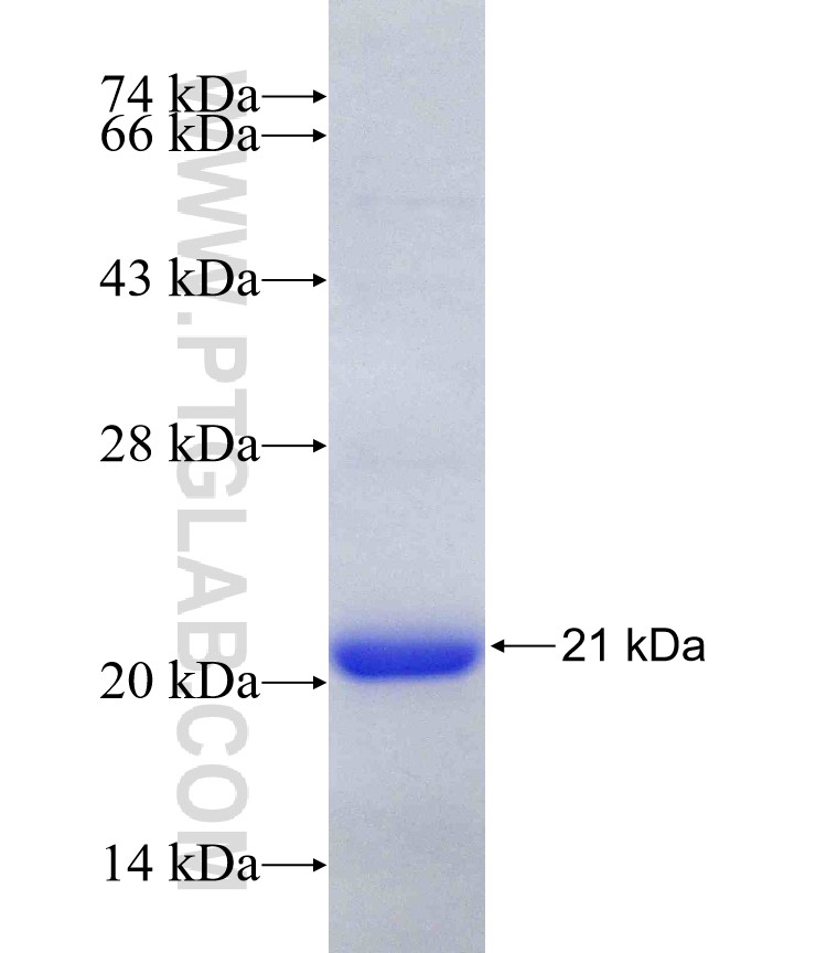 4EBP1 fusion protein Ag18985 SDS-PAGE