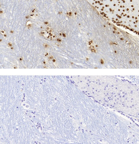 5-Methylcytosine (5-mc) antibody (pAb) tested by Immunohistochemistry Punctate nuclear staining pattern is detected in Formalin-fixed, paraffin-embedded tissue sections from human substantia nigra (midbrain). Top Panel: 5-mC antibody at 1:1000 dilution. Bottom Panel: No primary antibody (2nd step antibody alone)