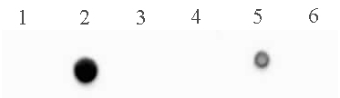 5-Methylcytosine (5-mC) antibody (mAb) tested by dot blot analysis. DNA from the Methylated DNA Standard Kit (Catalog No. 55008) were spotted (5 ng per spot) on to a positively charged nylon membrane and blotted with 5-Methylcytosine antibody (2 ug/ml dilution). Lane 1: single-stranded unmethylated DNA. Lane 2: single-stranded DNA containing 5-methylcytosine. Lane 3: single-stranded DNA containing 5-hydroxymethylcytosine. Lane 4: double-stranded unmethylated DNA. Lane 5: double-stranded DNA containing 5-methylcytosine. Lane 6: double-stranded DNA 5-hydroxymethylcytosine. 5-Methylcytosine (5-mC) antibody (mAb) tested by dot blot analysis. DNA from the Methylated DNA Standard Kit (Catalog No. 55008) were spotted (5 ng per spot) on to a positively charged nylon membrane and blotted with 5-Methylcytosine antibody (2 ug/ml dilution). Lane 1: single-stranded unmethylated DNA. Lane 2: single-stranded DNA containing 5-methylcytosine. Lane 3: single-stranded DNA containing 5-hydroxymethylcytosine. Lane 4: double-stranded unmethylated DNA. Lane 5: double-stranded DNA containing 5-methylcytosine. Lane 6: double-stranded DNA 5-hydroxymethylcytosine.