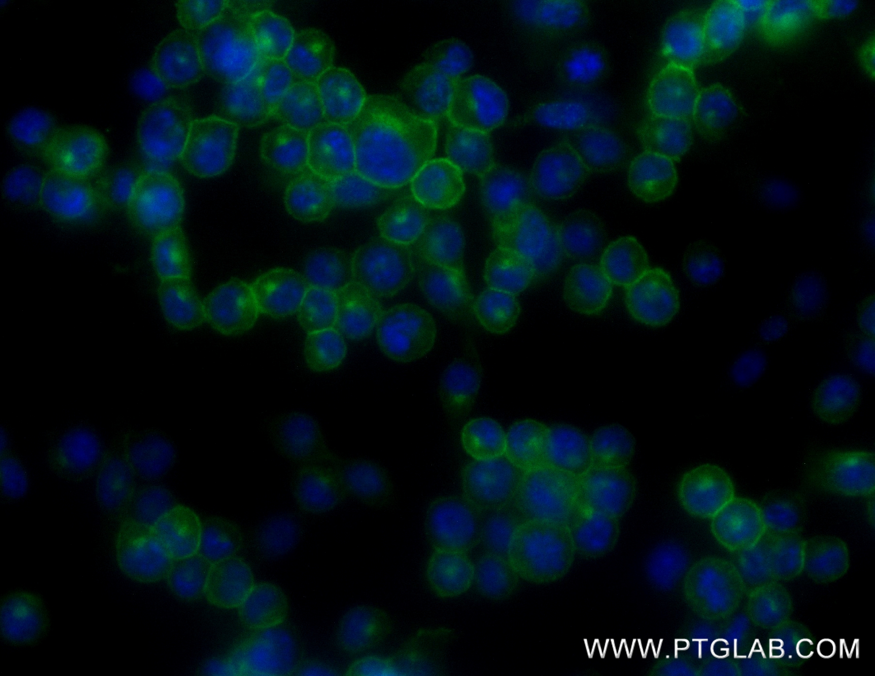 IF Staining of 4T1 using 84434-4-RR