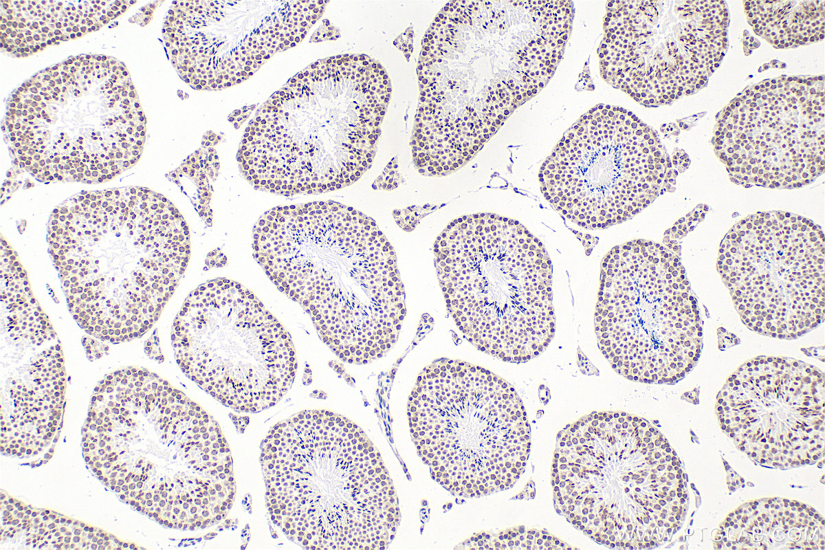 IHC staining of mouse testis using Biotin-68301
