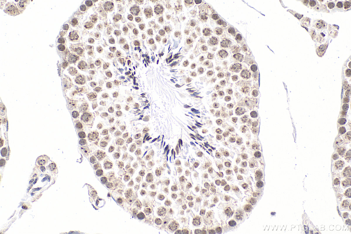 IHC staining of mouse testis using Biotin-68301