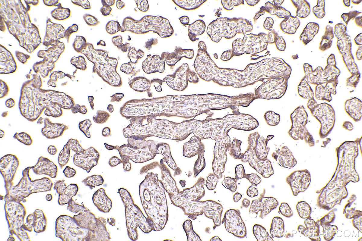 IHC staining of human placenta using 26550-1-AP
