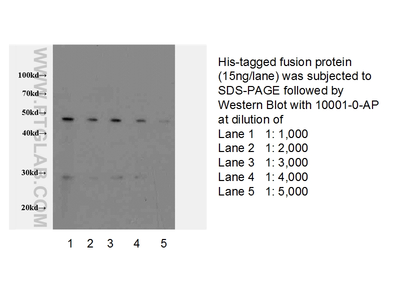 6*his,His tag Antibody WB recombinant protein  10001-0-AP