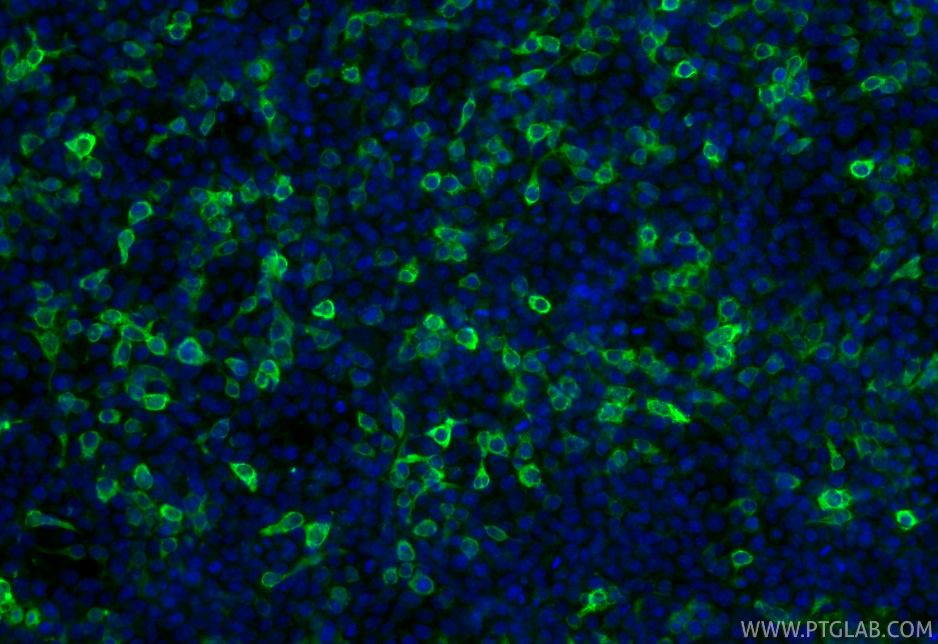 IF Staining of Transfected HEK-293 using 10001-0-AP