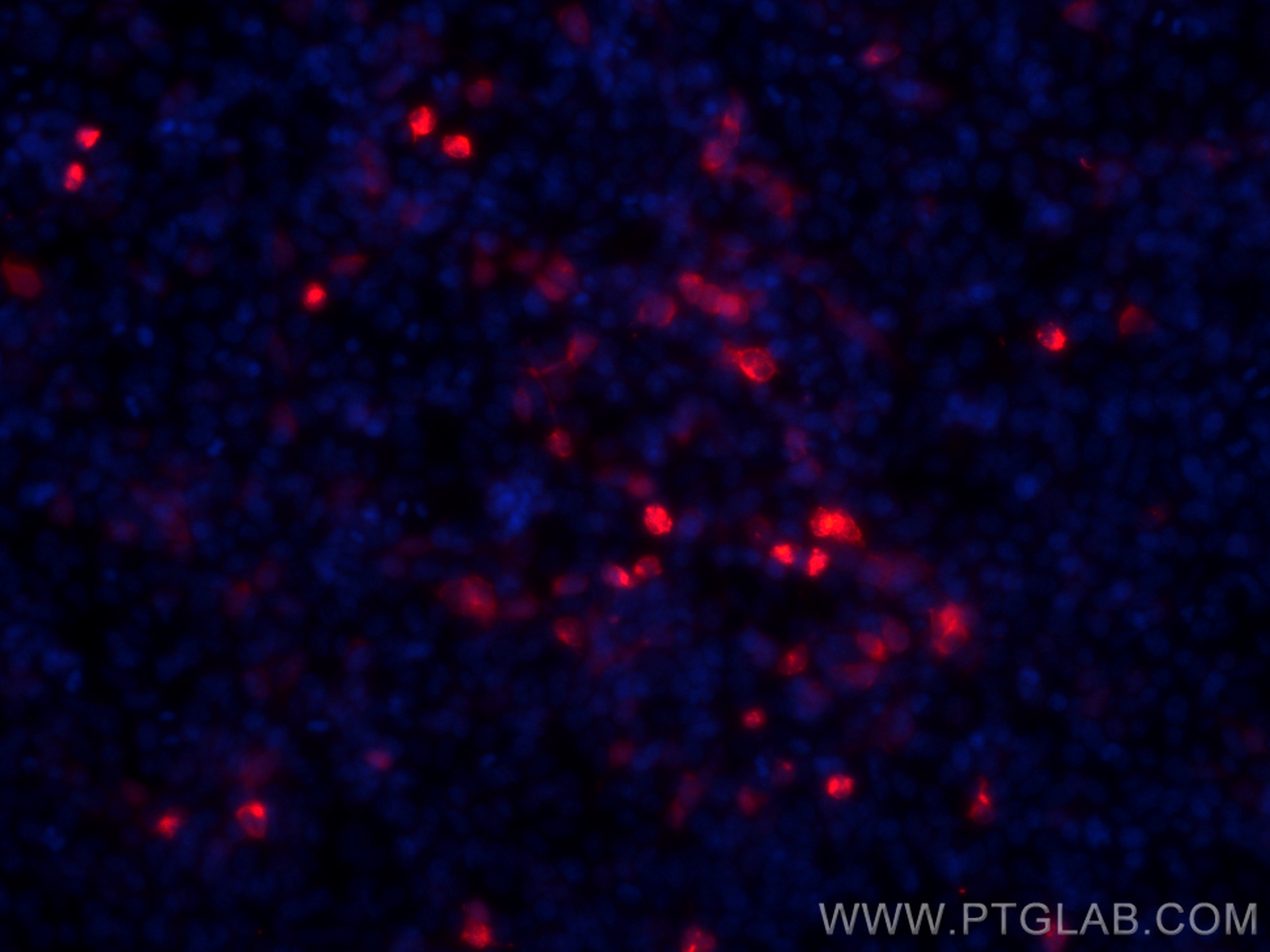 IF Staining of Transfected HEK-293 using CL594-84814