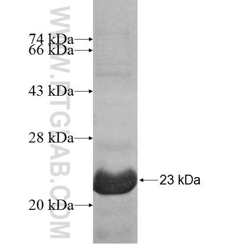 8858-1/1 fusion protein Ag10021 SDS-PAGE