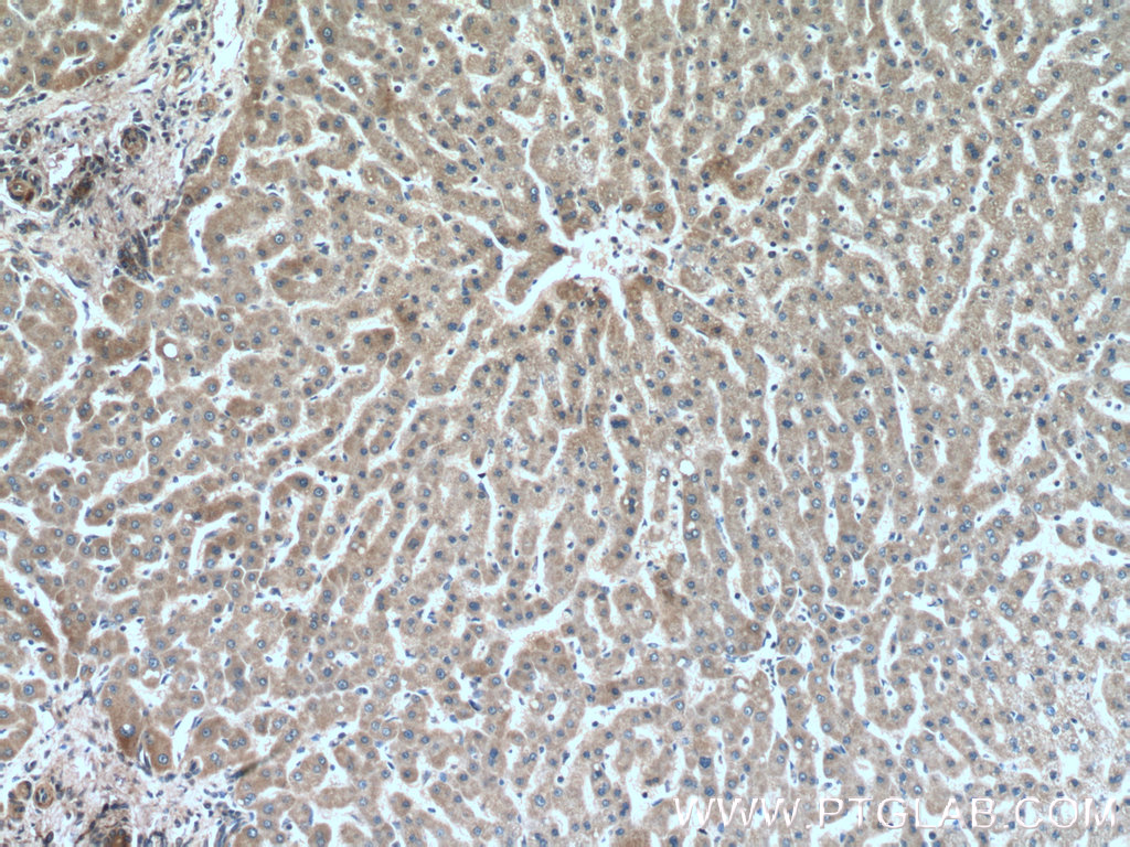 IHC staining of human liver using 66260-1-Ig