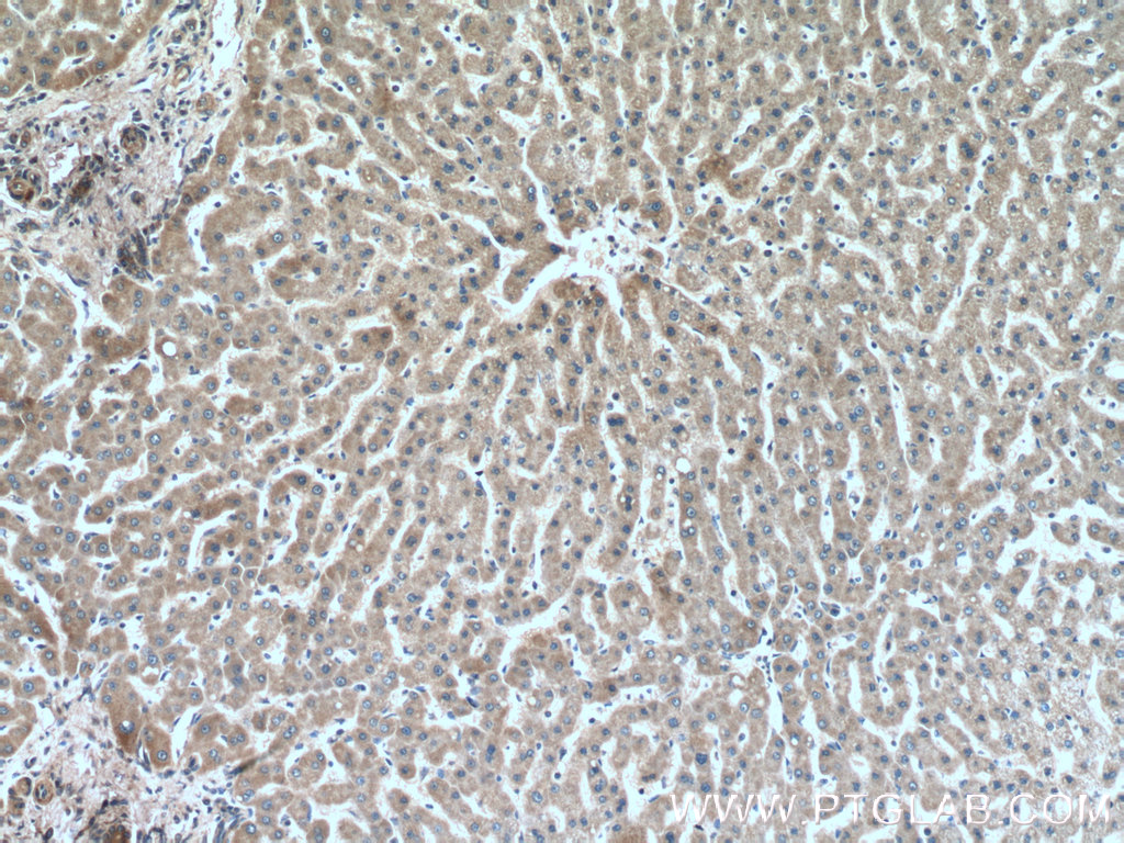 IHC staining of human liver using 66260-1-Ig (same clone as 66260-1-PBS)