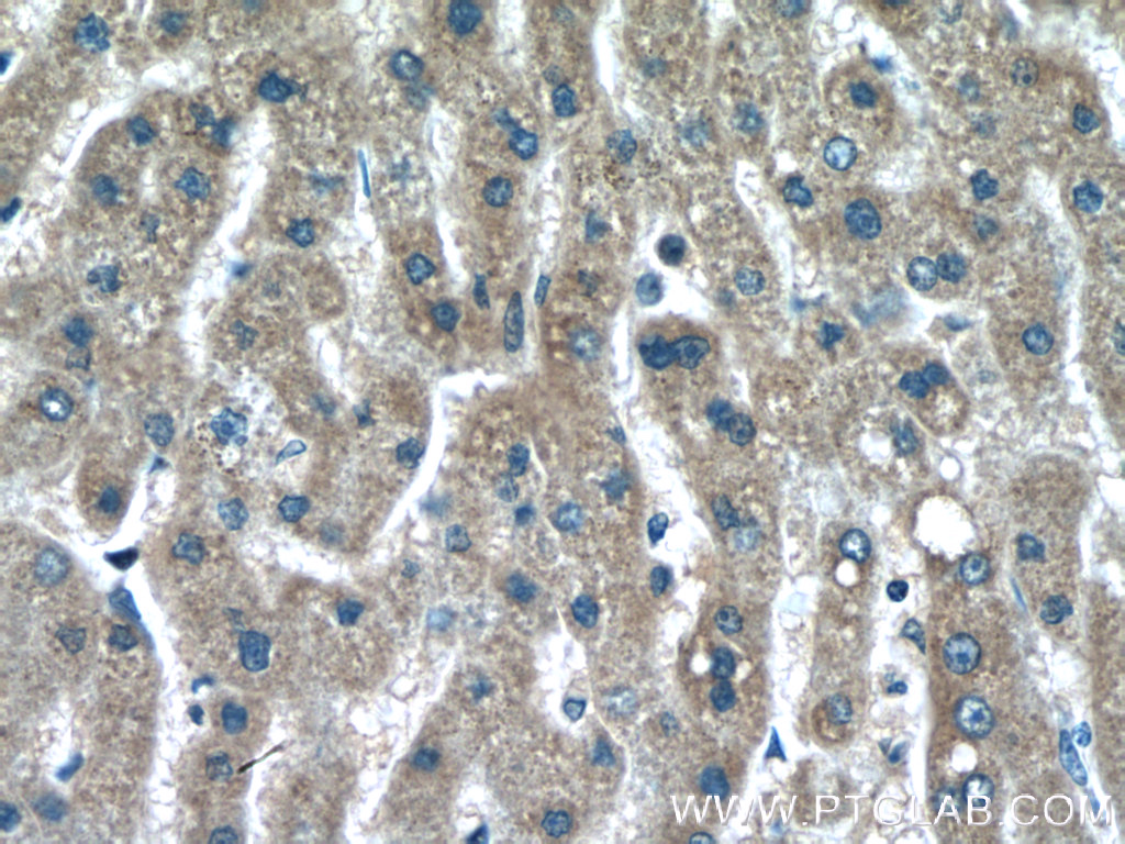IHC staining of human liver using 66260-1-Ig (same clone as 66260-1-PBS)