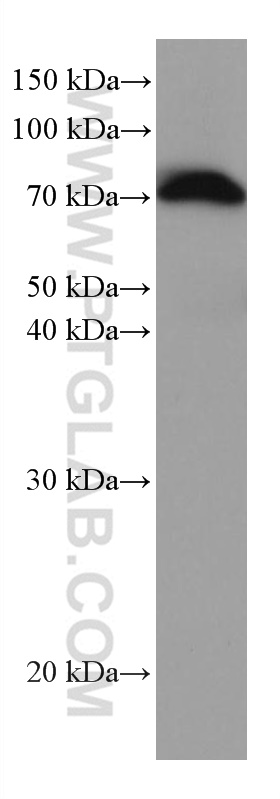 WB analysis of human plasma using 66260-1-Ig (same clone as 66260-1-PBS)