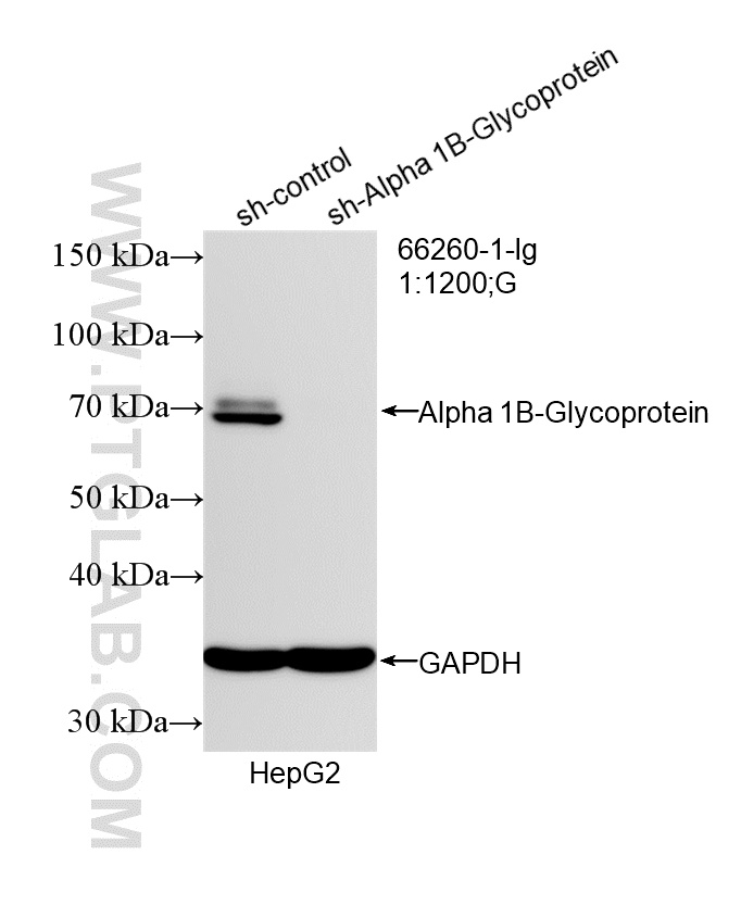 WB analysis of HepG2 using 66260-1-Ig WB analysis of HepG2 using 66260-1-Ig