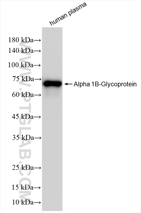 WB analysis of human plasma using 86112-1-RR (same clone as 86112-1-PBS)