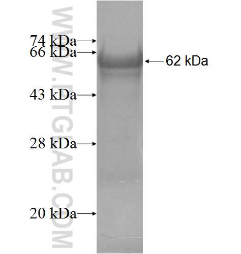 A1BG fusion protein Ag5414 SDS-PAGE