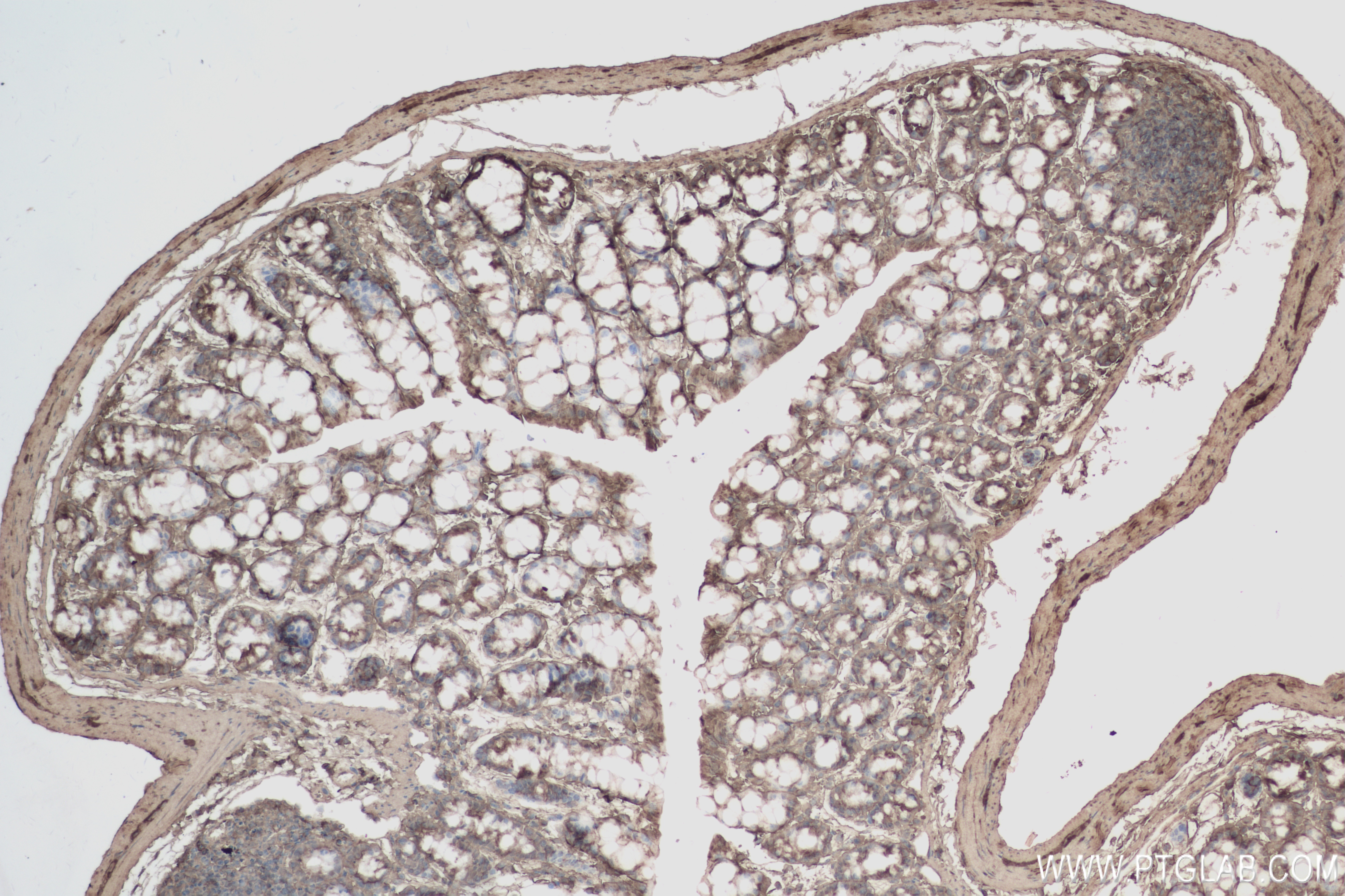 IHC staining of mouse colon using 84322-4-RR (same clone as 84322-4-PBS)