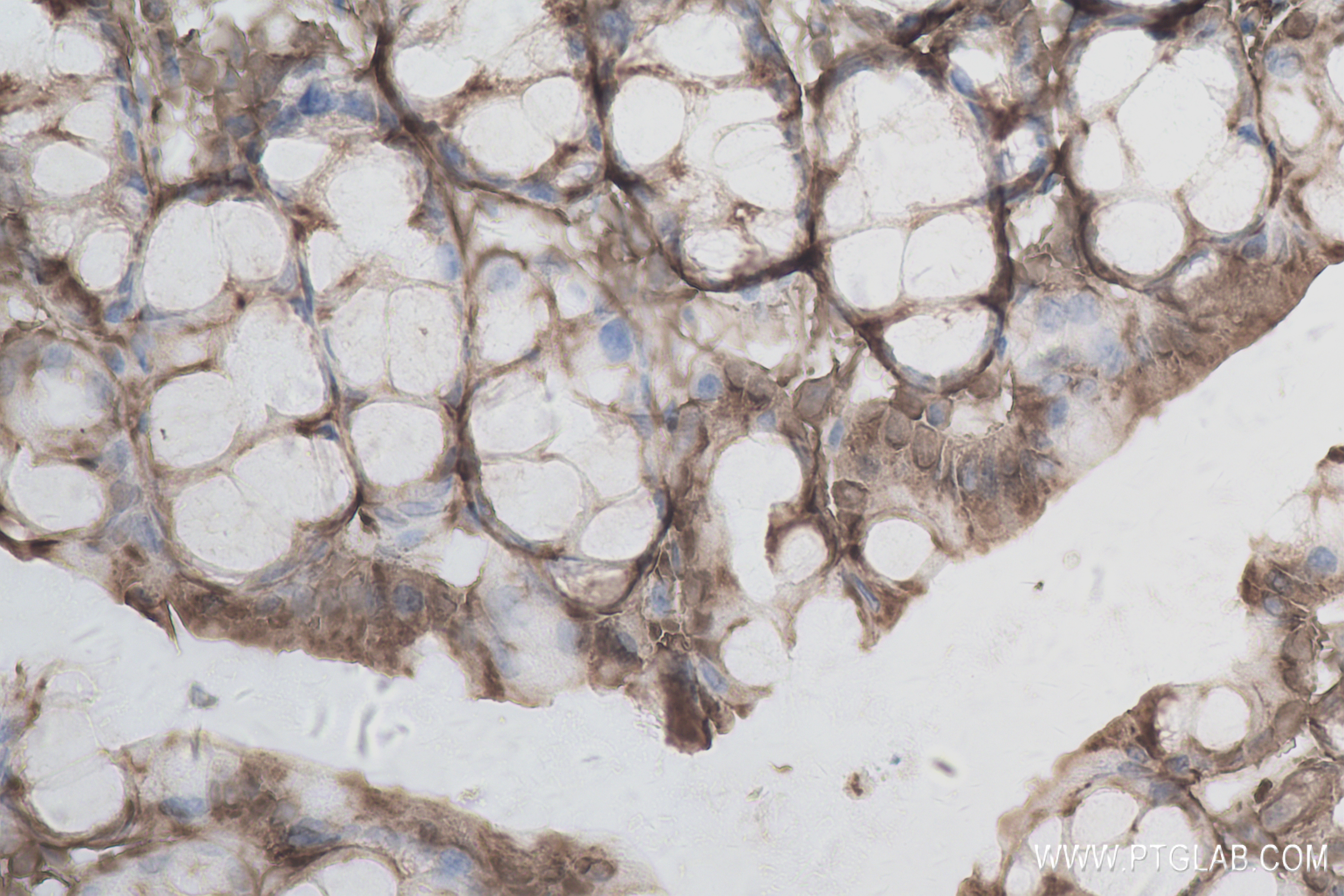 IHC staining of mouse colon using 84322-4-RR (same clone as 84322-4-PBS)
