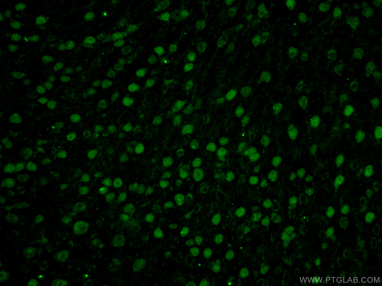 IF Staining of mouse brain using 22647-1-AP