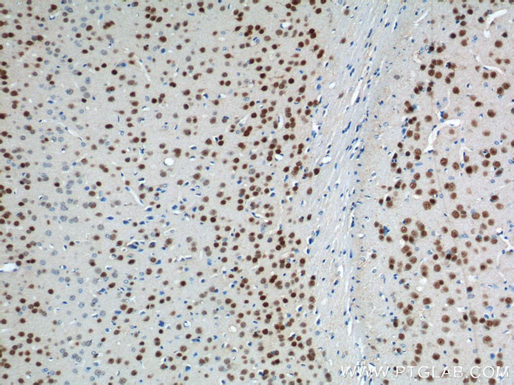 IHC staining of mouse brain using 22647-1-AP