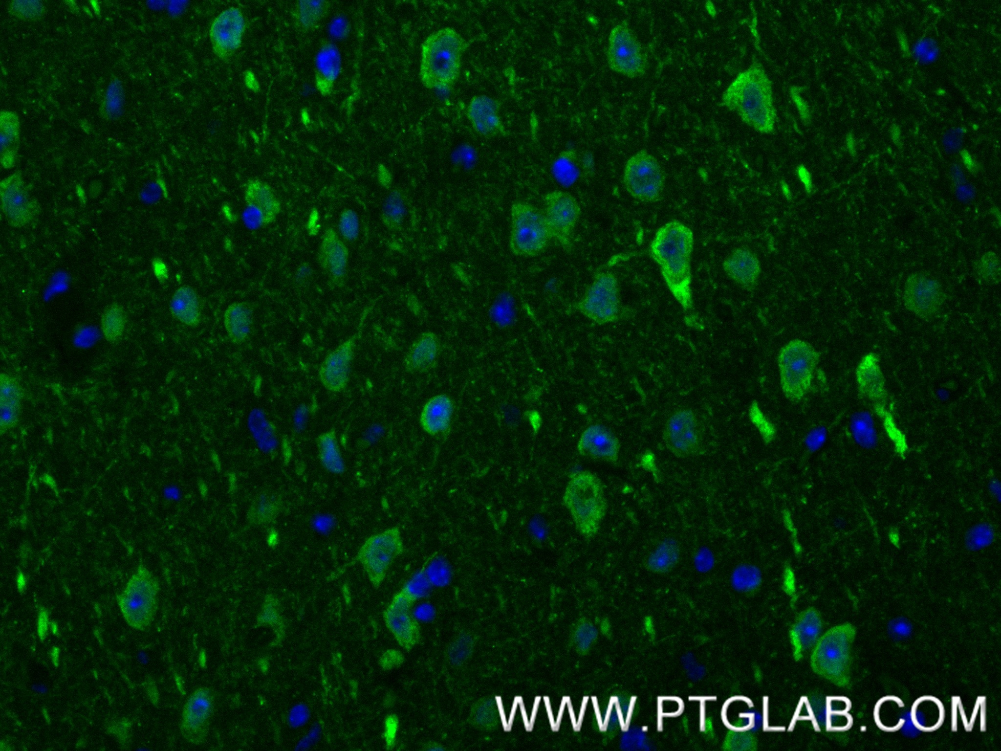 IF Staining of mouse brain using 85732-2-RR