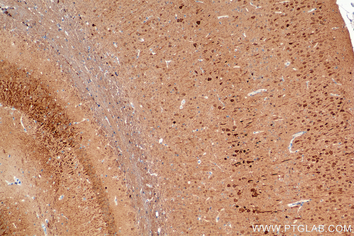 IHC staining of mouse brain using 85732-2-RR