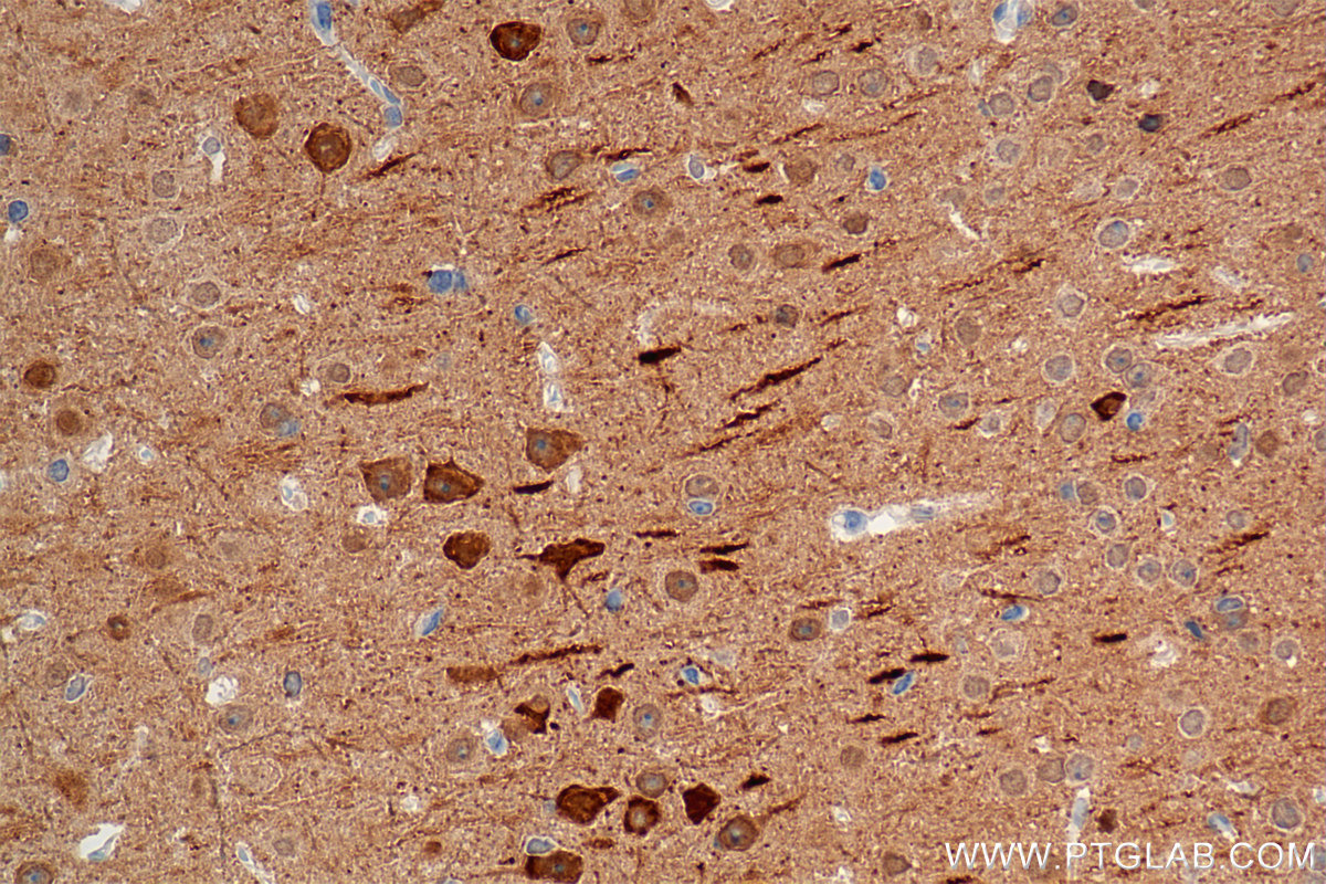 IHC staining of mouse brain using 85732-2-RR