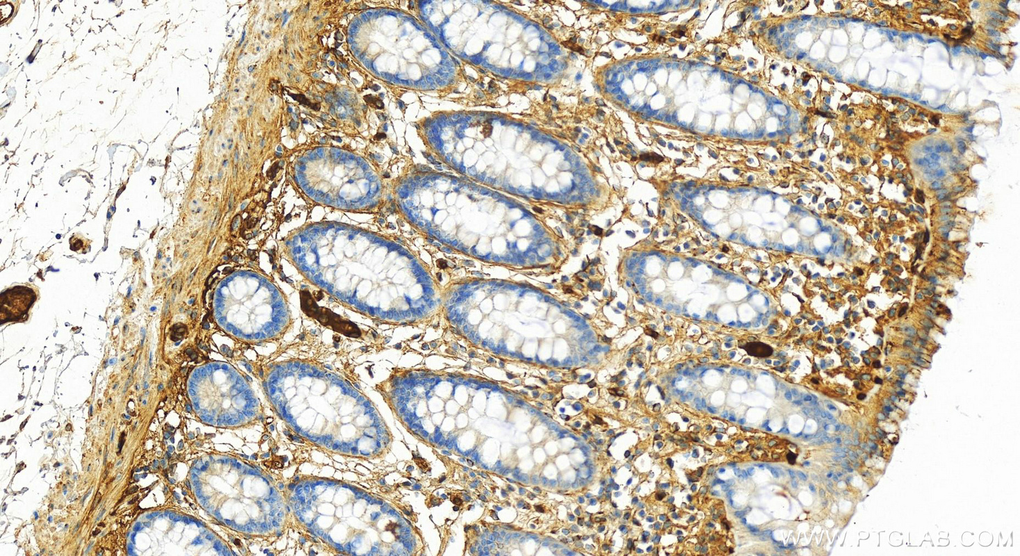 IHC staining of human colon using 13545-1-AP