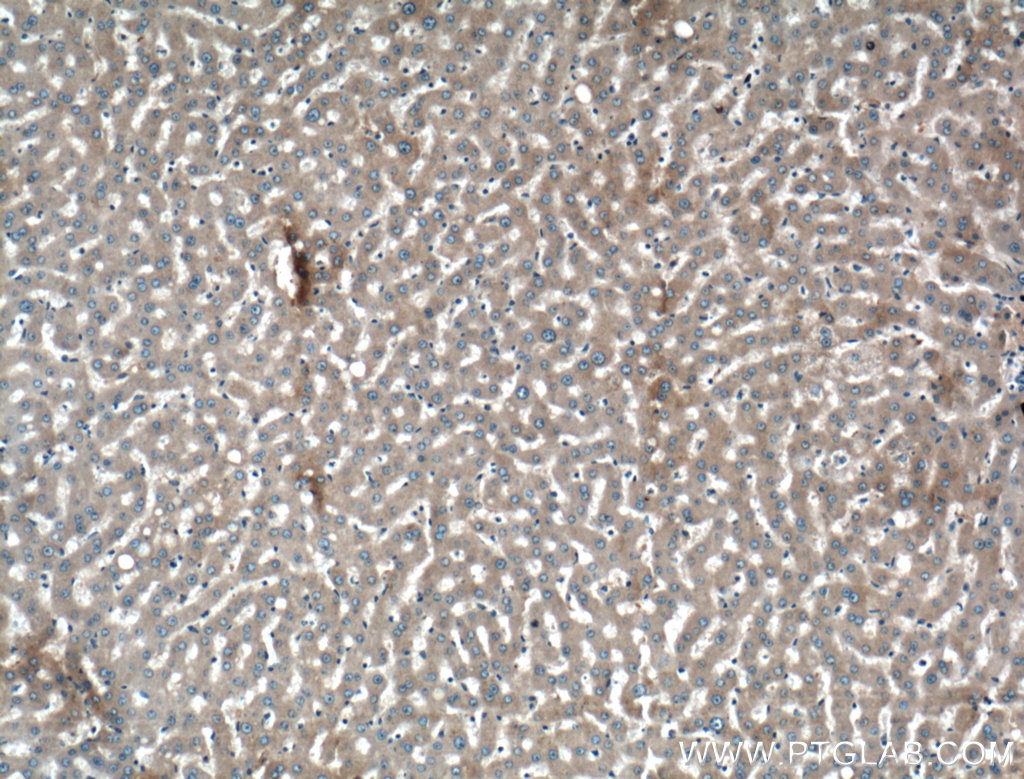 IHC staining of human liver using 13545-1-AP