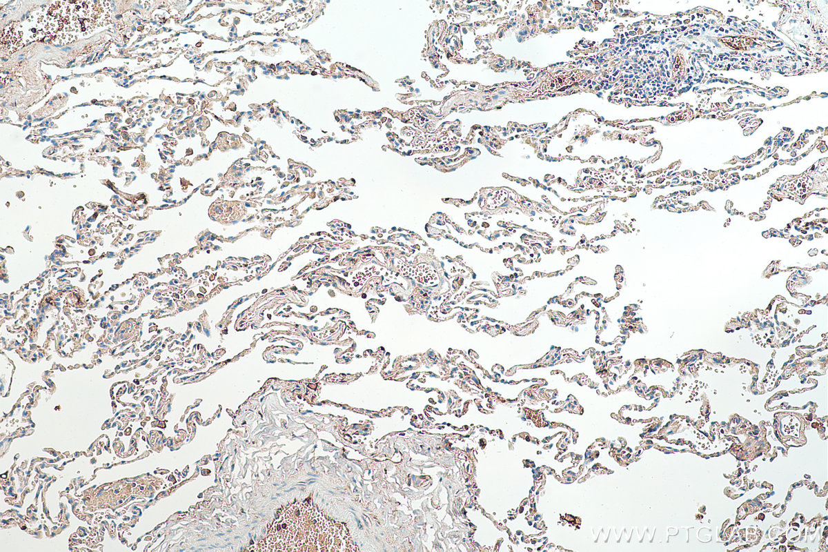 IHC staining of human lung using 66126-1-Ig IHC staining of human lung using 66126-1-Ig