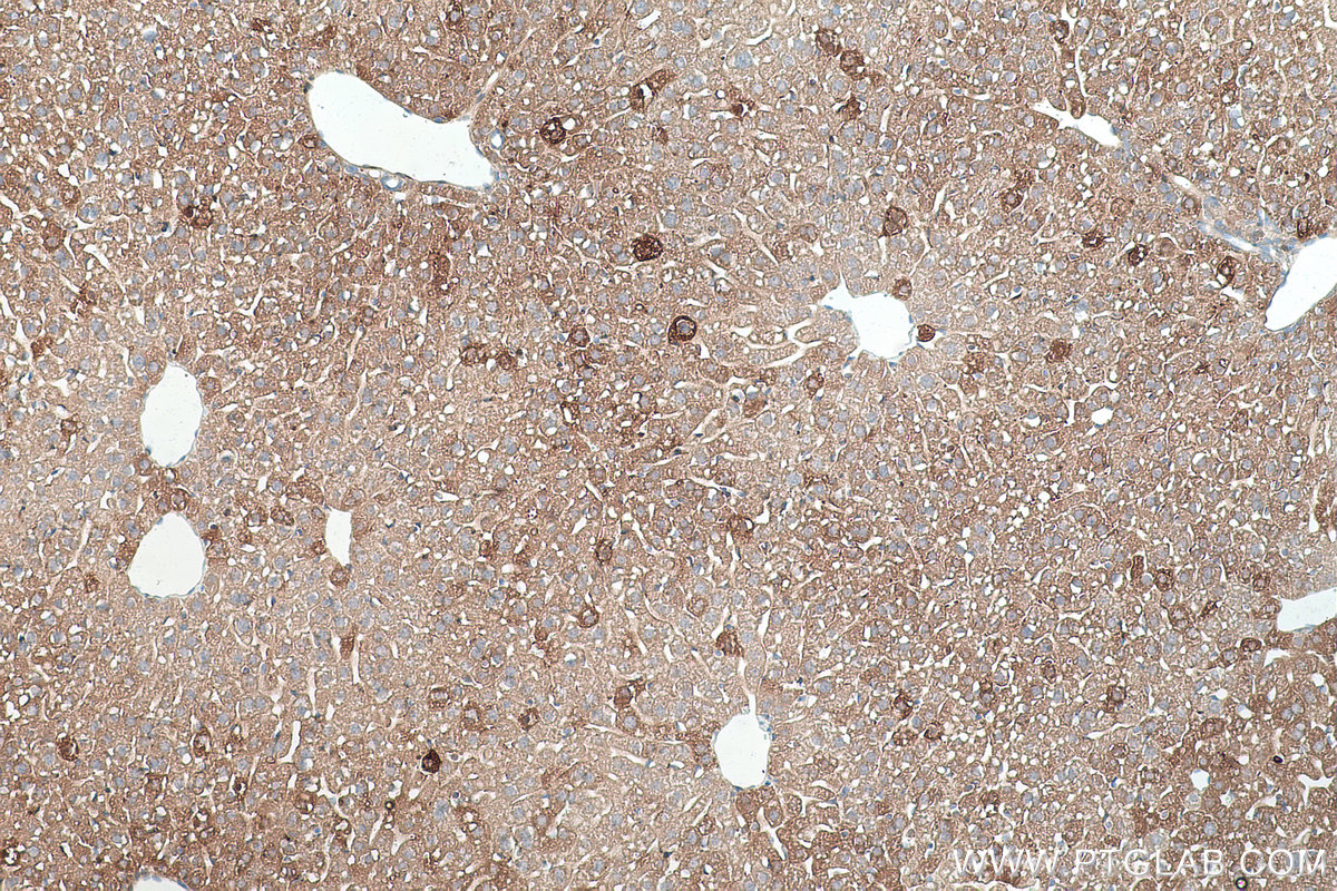 IHC staining of mouse liver using 66126-1-Ig IHC staining of mouse liver using 66126-1-Ig