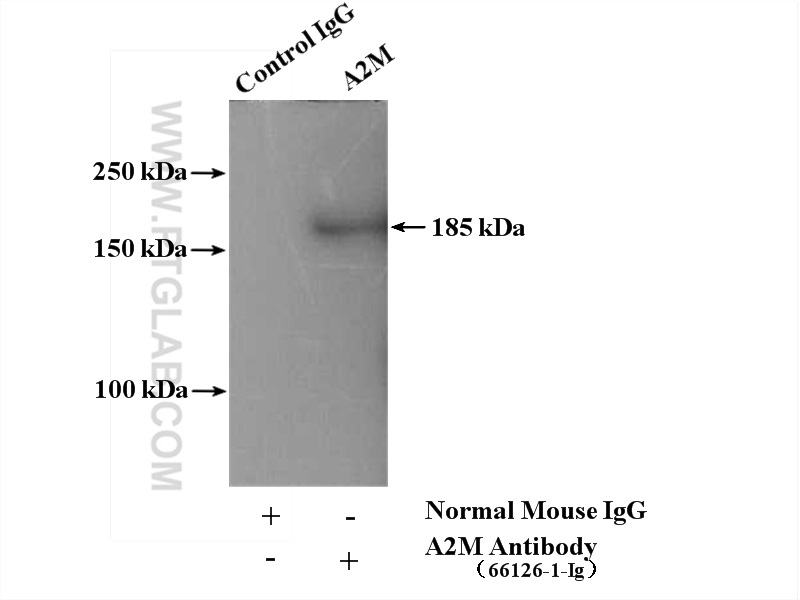 IP experiment of human plasma using 66126-1-Ig (same clone as 66126-1-PBS)