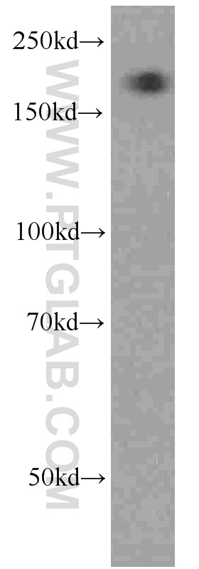 WB analysis of HepG2 using 66126-1-Ig (same clone as 66126-1-PBS)