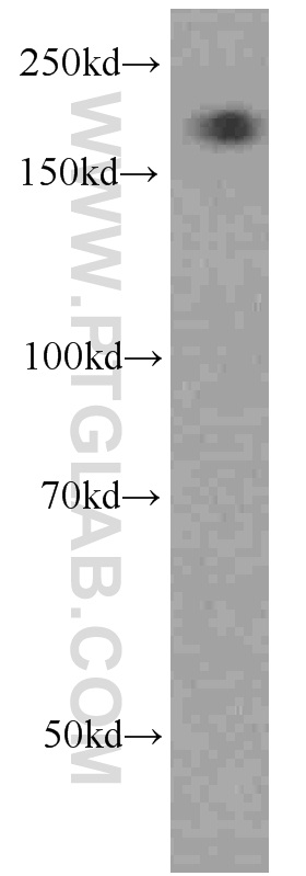 WB analysis of HepG2 using 66126-1-Ig